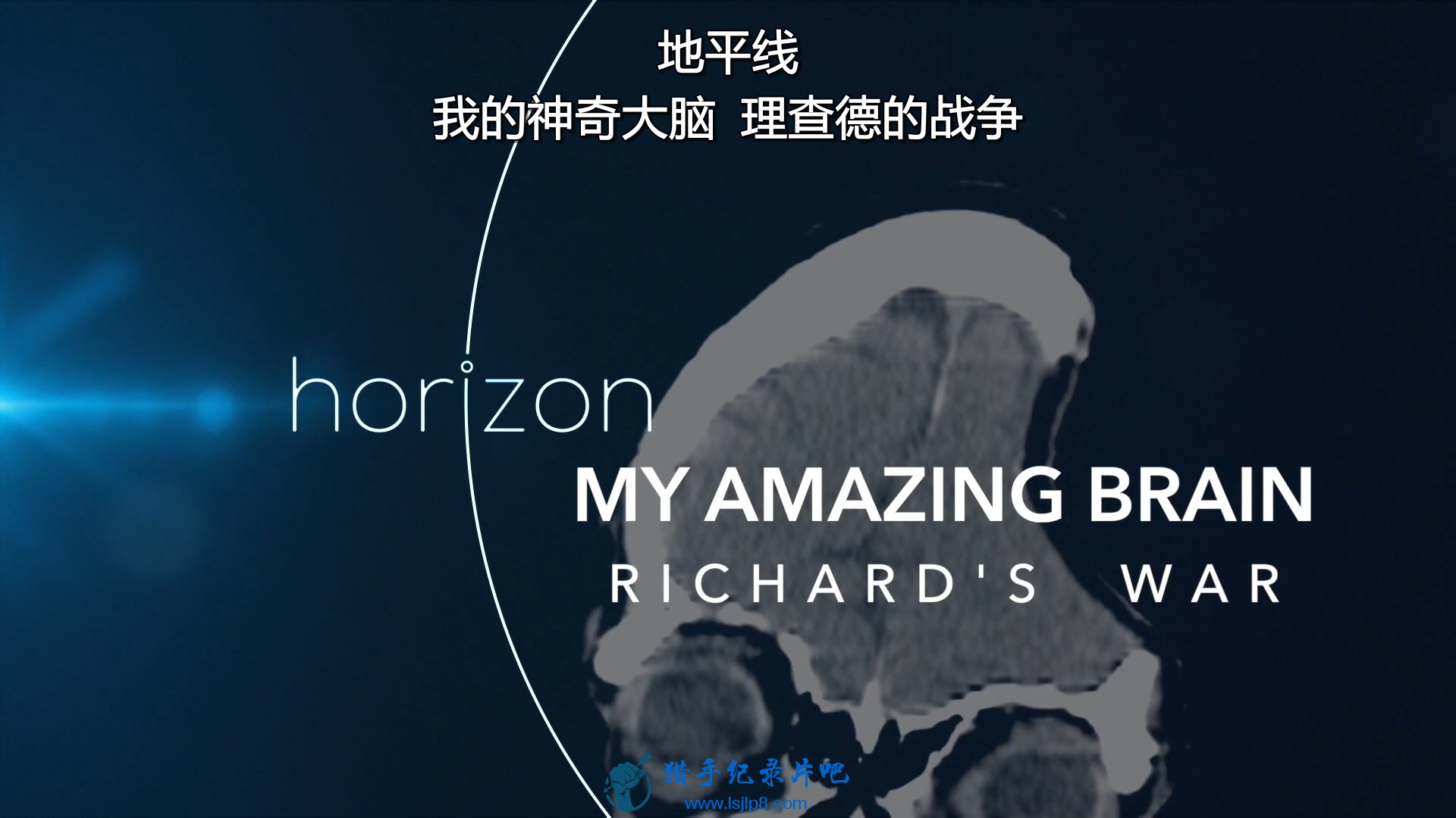 BBC.Horizon.2018.My.Amazing.Brain.1080p.HDTV.x264.AAC.mkv[eztv].mkv_20191019_085.jpg