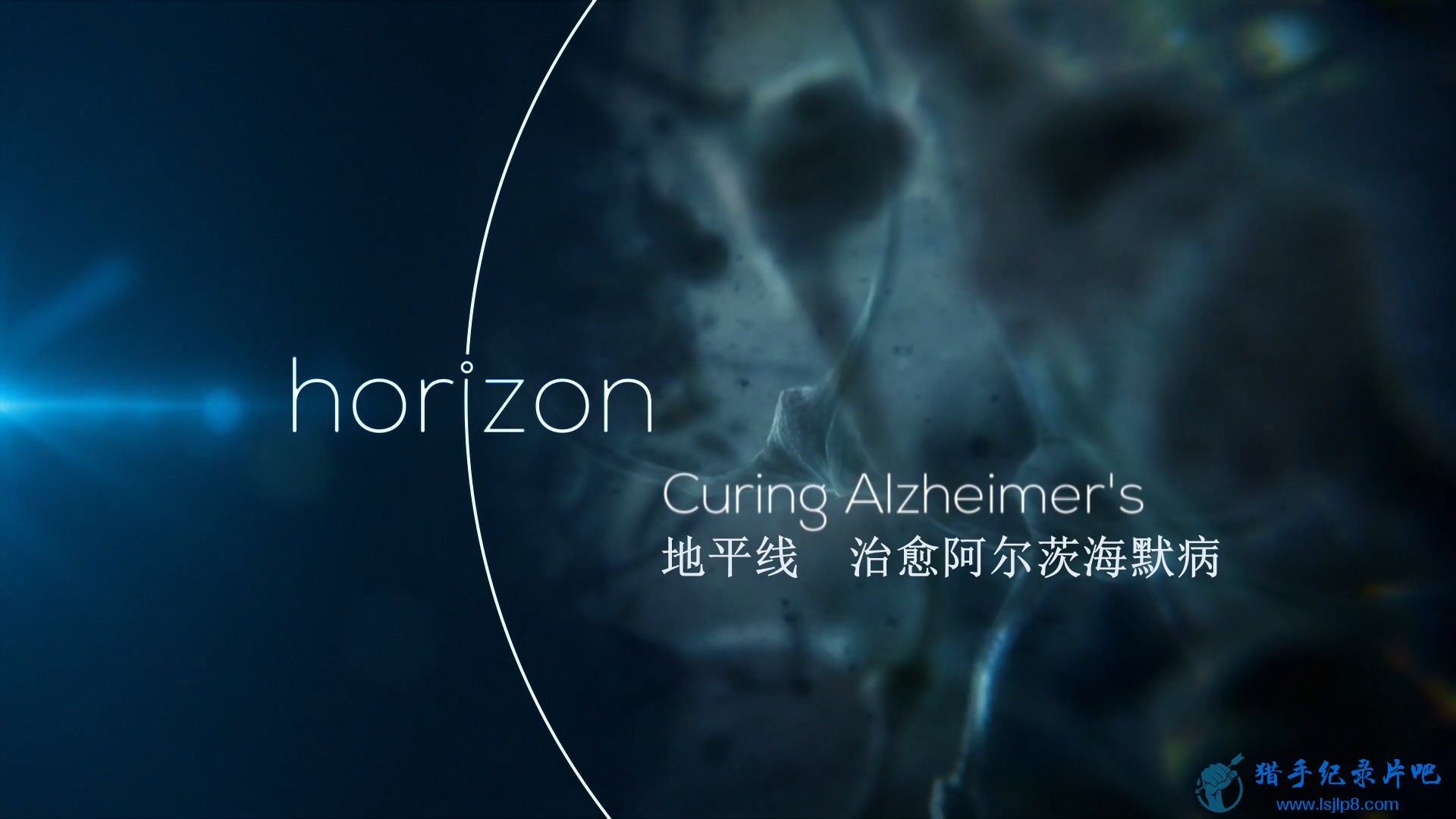 Horizon.2016.Curing.Alzheimers.1080p.x264.HDTV[eztv].mkv_20200613_083036.353_ͼ.jpg